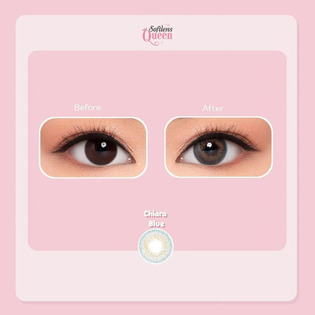 Pink Rabbit Chiara Blue - Softlens Queen Contact Lenses